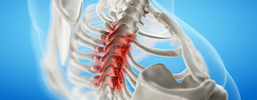 patient needing Spinal Stenosis in need of Spinal Decompression Therapy in Sacramento